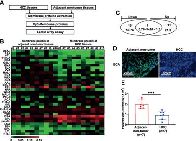 Abnormal ECA-Binding Membrane Glycans and Galactosylated CAT and P4HB in Lesion Tissues as Potential Biomarkers for Hepatocellular Carcinoma Diagnosis